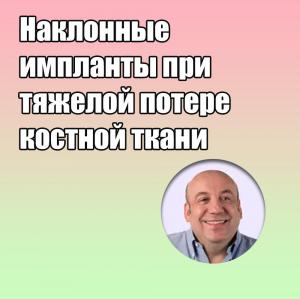 Видеозапись. Энрико Альярди - Наклонные импланты при тяжелой потере костной ткани - Книги по имплантологии (фото 1)