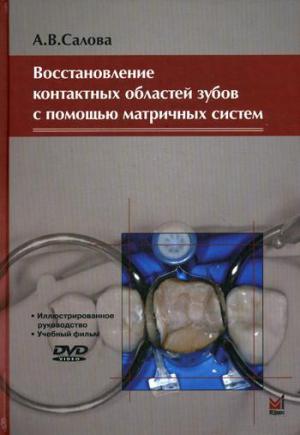 Салова А.В. - ​ Восстановление контактных областей зубов с помощью матричных систем. 2-е изд., + CD - Книги по терапевтической стоматологии (фото 1)