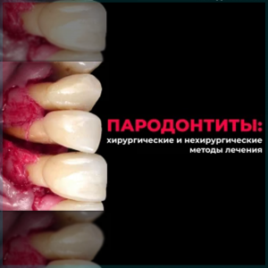 Видеозапись. Андреа Пиллони - Лечение агрессивных форм пародонтита - Книги по пародонтологии (фото 1)