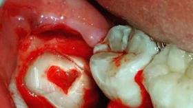 Зубная любовь 7