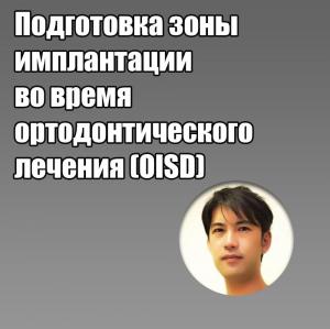 Видеозапись. Цутому Танно - Подготовка зоны имплантации во время ортодонтического лечения (OISD) - Книги по имплантологии (фото 1)