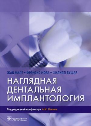 Жак Мале, Фрэнсис Мора, Филипп Бушар - Наглядная дентальная имплантология - Книги по имплантологии (фото 1)