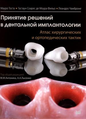 Мауро Тоста, Гастаун Соарес Де Моура Фильо, Леандро Чамброне - Принятие решений в дентальной имплантологии. Атлас хирургических и ортопедических тактик - Книги по имплантологии (фото 1)