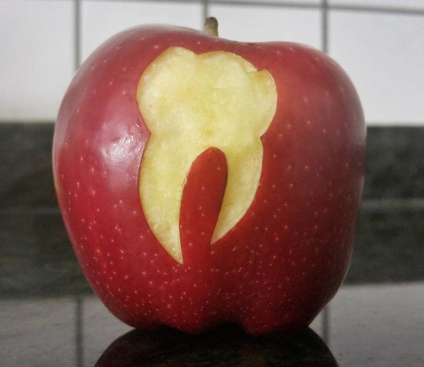 Яблочный зуб 2