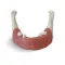GF Dental E82 Модель нижней челюсти для практики установки имплантатов - Модели для практики (муляжи, тренажеры) (фото 2)