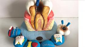 Торт эндодонтический 4