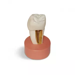 GF Dental DM26 Увеличенная модель зуба со вкладкой для демонстрации, высота 9 см - Демонстрационные модели (фото 1)