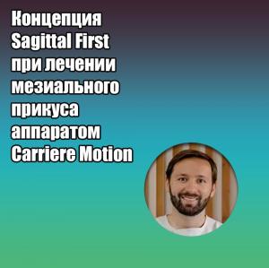 Видеозапись. Пери Колино Гальярдо - Концепция Sagittal First при лечении мезиального прикуса аппаратом Carriere Motion - Книги по ортодонтии (фото 1)