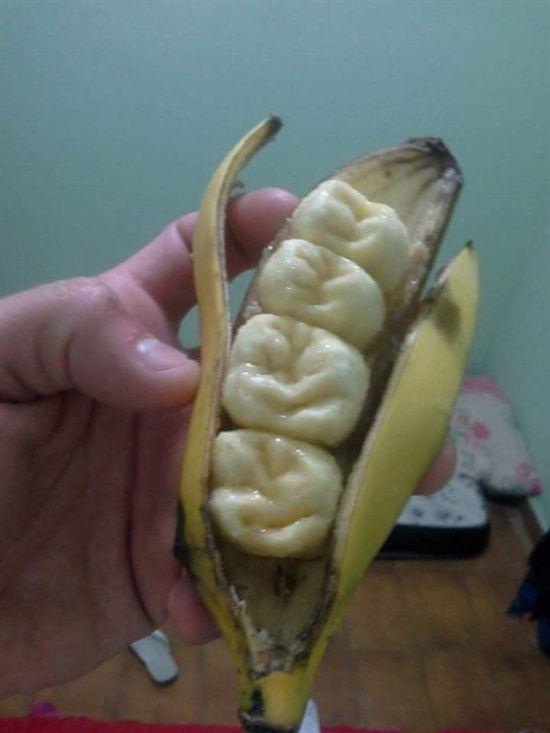 Банановые зубы