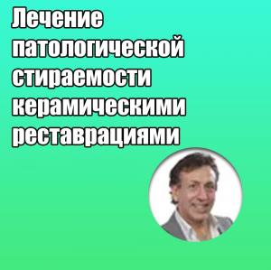 Видеозапись. Маурицио Де Стефано - Лечение патологической стираемости керамическими реставрациями - Книги по ортопедической стоматологии (фото 1)