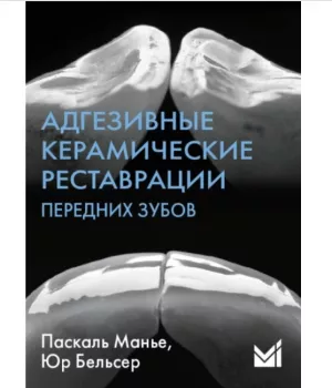 Паскаль Манье, Юр Бельсер - Адгезивные керамические реставрации передних зубов - Книги по ортопедической стоматологии (фото 1)