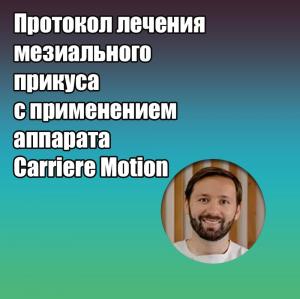 Видеозапись. Пери Колино Гальярдо - Протокол лечения мезиального прикуса с применением аппарата Carriere Motion - Книги по ортодонтии (фото 1)
