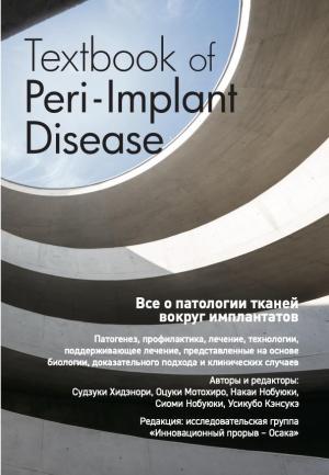 Судзуки Хидэнори - Все о патологии тканей вокруг имплантатов - Книги по имплантологии (фото 1)