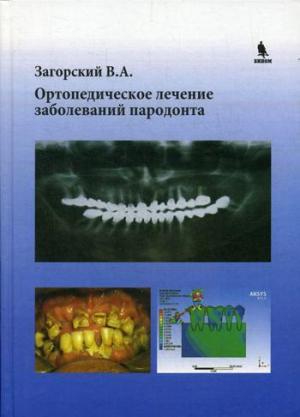 Загорский В.А - Ортопедическое лечение заболеваний пародонта, Бином - Книги по ортопедической стоматологии (фото 1)