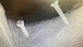 Что за имплантаты?