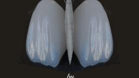 Зубной мотылек