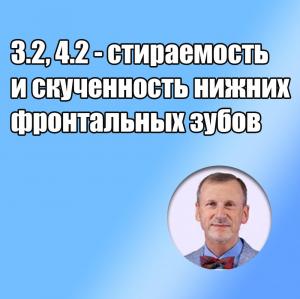Видеозапись. Сергей Радлинский - 3.2, 4.2 - стираемость и скученность нижних фронтальных зубов - Книги по общей стоматологии (фото 1)