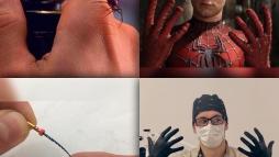 Человек-паук и стоматолог