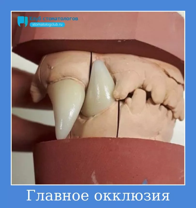Главное окклюзия