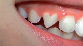 Зубная любовь 14