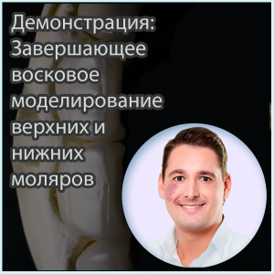 Видеозапись. Инго Рётеле - Демонстрация: Завершающее восковое моделирование верхних и нижних моляров - Книги для зубных техников (фото 1)