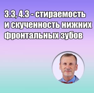 Видеозапись. Сергей Радлинский - 3.3, 4.3 - стираемость и скученность нижних фронтальных зубов - Книги по реставрационной стоматологии (фото 1)