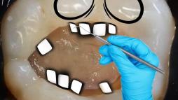 Зуб на приеме у стоматолога