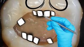 Зуб на приеме у стоматолога