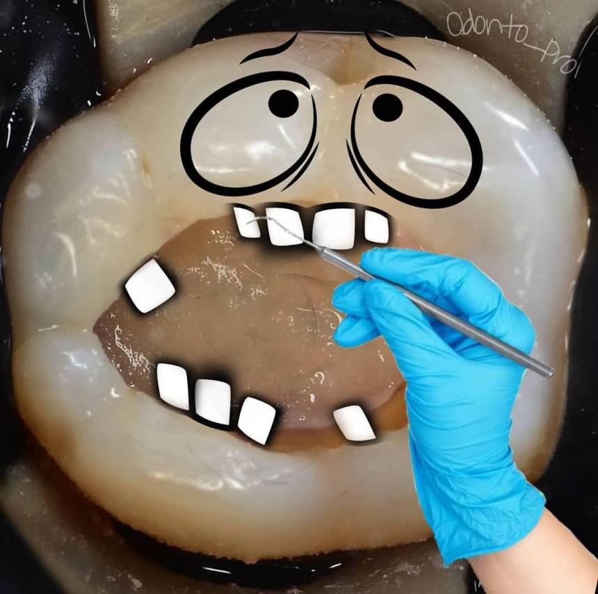 Зуб на приеме у стоматолога