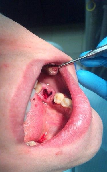 Валентинка от стоматолога