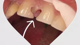 Зубная любовь 1