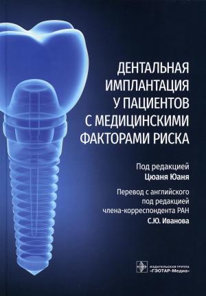 Цюань Юань - ​ Дентальная имплантация у пациентов с медицинскими факторами риска - Книги по имплантологии (фото 1)