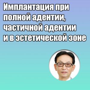 Видеозапись. Акиёси Фунато - Имплантация при полной адентии, частичной адентии и в эстетической зоне - Книги по имплантологии (фото 1)