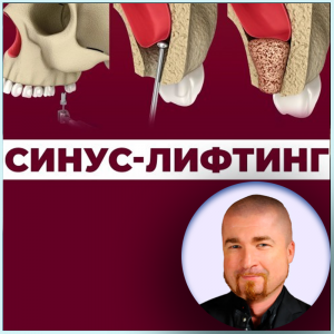 Видеозапись. Радослав Ядач - Принципы диагностики. Формирование и дизайн лоскута - Книги по хирургической стоматологии (фото 1)