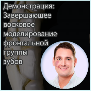 Видеозапись. Инго Рётеле - Демонстрация: Завершаюшее восковое моделирование фронтальной группы зубов - Книги для зубных техников (фото 1)