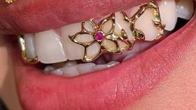 Грилзы на зубы 7