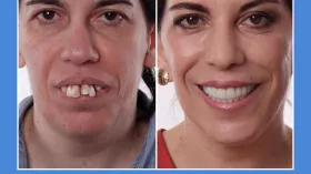 Photoshop? Стоматолог!