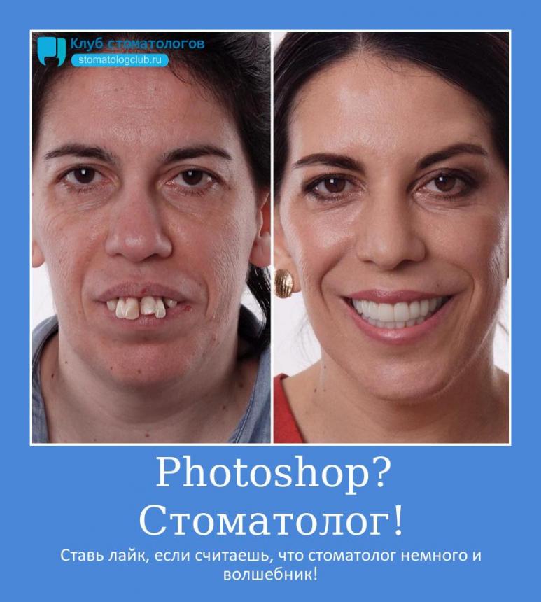 Photoshop? Стоматолог!