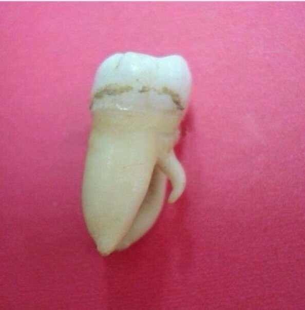 Зуб - мальчик