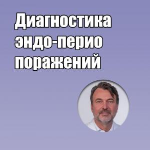 Видеозапись. Матиас Цендер - Диагностика эндо-перио поражений - Книги по эндодонтии (фото 1)