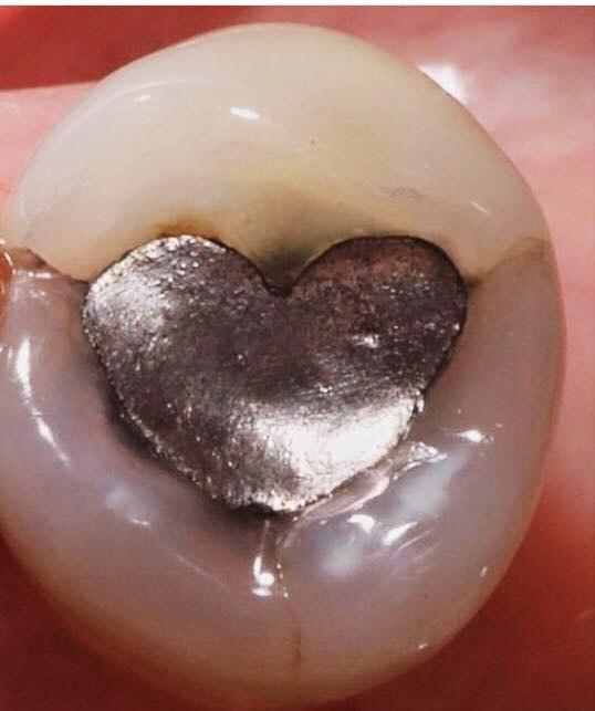 Когда стоматолог влюблен