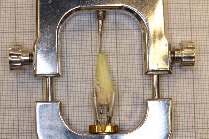Разработали устройство для сбора стволовых клеток из пульпы зуба