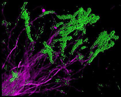 Ученые создали карту микрофлоры ротовой полости