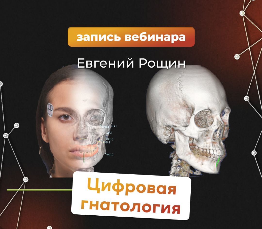 Купить Видеозапись. Евгений Рощин - Цифровая гнатология по выгодной цене -  Клуб стоматологов Маркете - Профессиональный стоматологический портал  (сайт) «Клуб стоматологов»