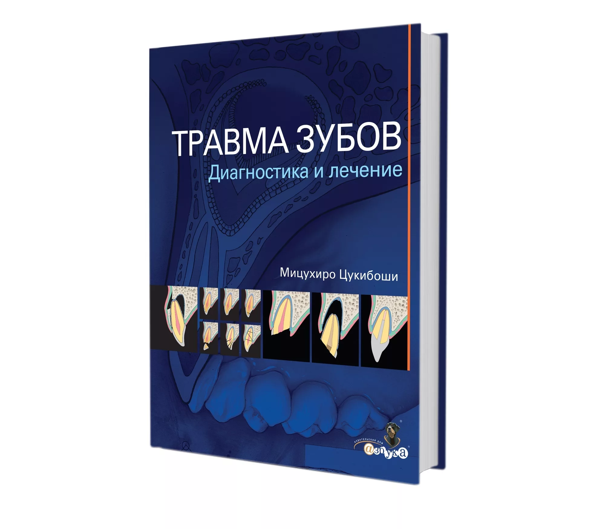 Купить Мицухиро Цукибоши - Травма зубов. Диагностика и лечение. по выгодной  цене - Клуб стоматологов Маркете - Профессиональный стоматологический  портал (сайт) «Клуб стоматологов»