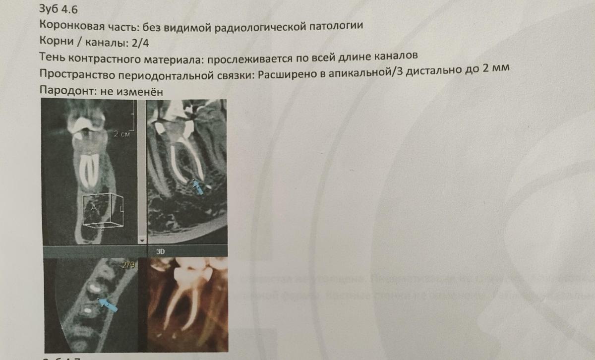 &quot; 