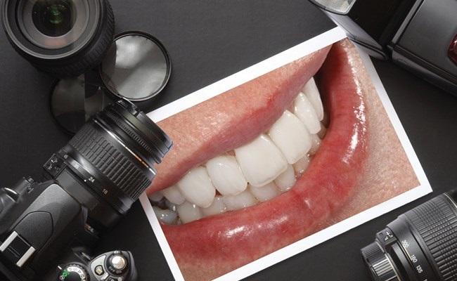 Введение в клиническую стоматологическую фотографию