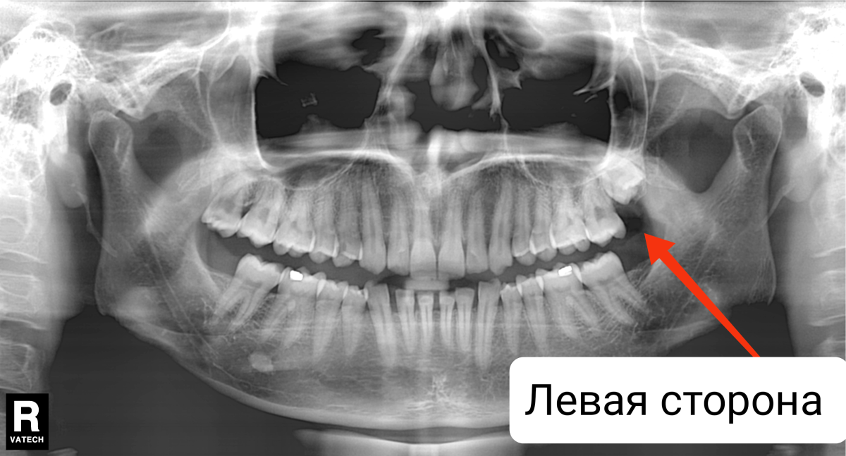 68efe211c0c90a5965502abb238a.png