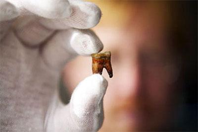 Ученые активно ищут способ выращивания зубов из стволовых клеток