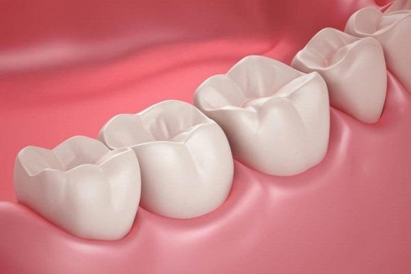 Новая методика помогает учёным понять, как кислота вредит зубам